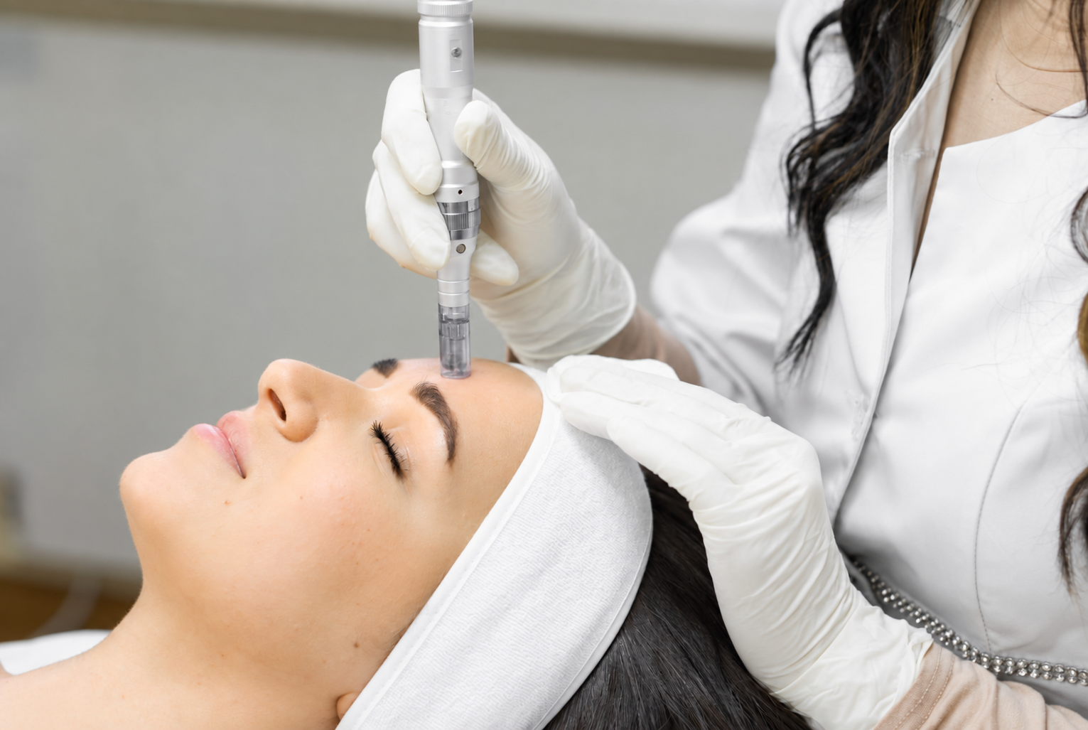 Microneedling Behandlung